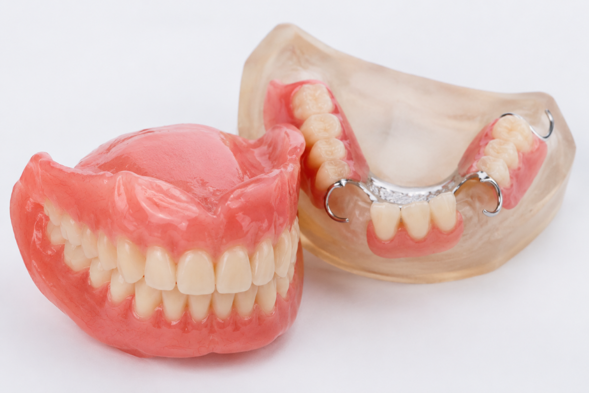 Dentures in Milton, Ontario, Full and Partial Denture Options | White Dove Dental Custom full and partial dentures in Milton crafted at White Dove Dental