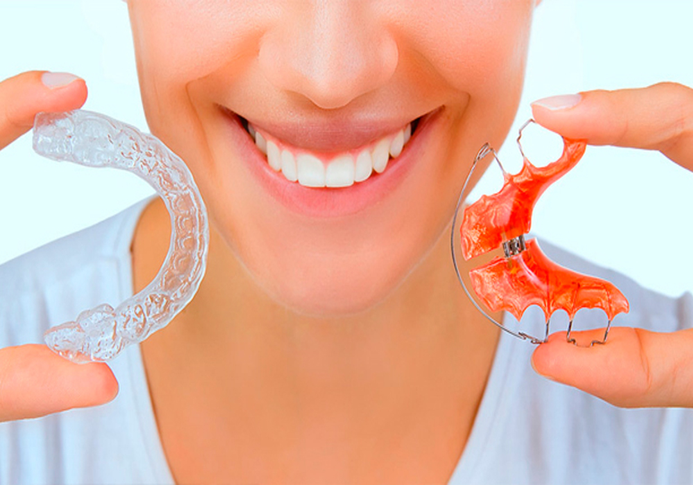 Orthodontic Retainers